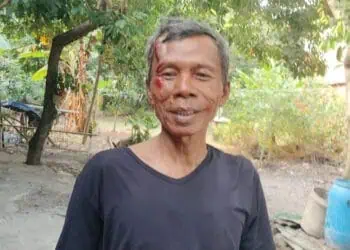 Baliho Bergambar Sachrudin-Airin Timpa Pengendara Motor, Korban Luka di Pelipis
