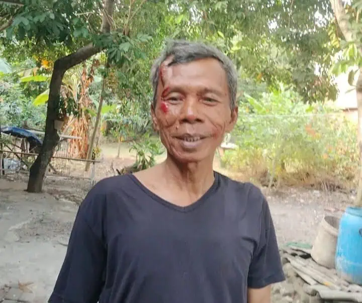 Baliho Bergambar Sachrudin-Airin Timpa Pengendara Motor, Korban Luka di Pelipis