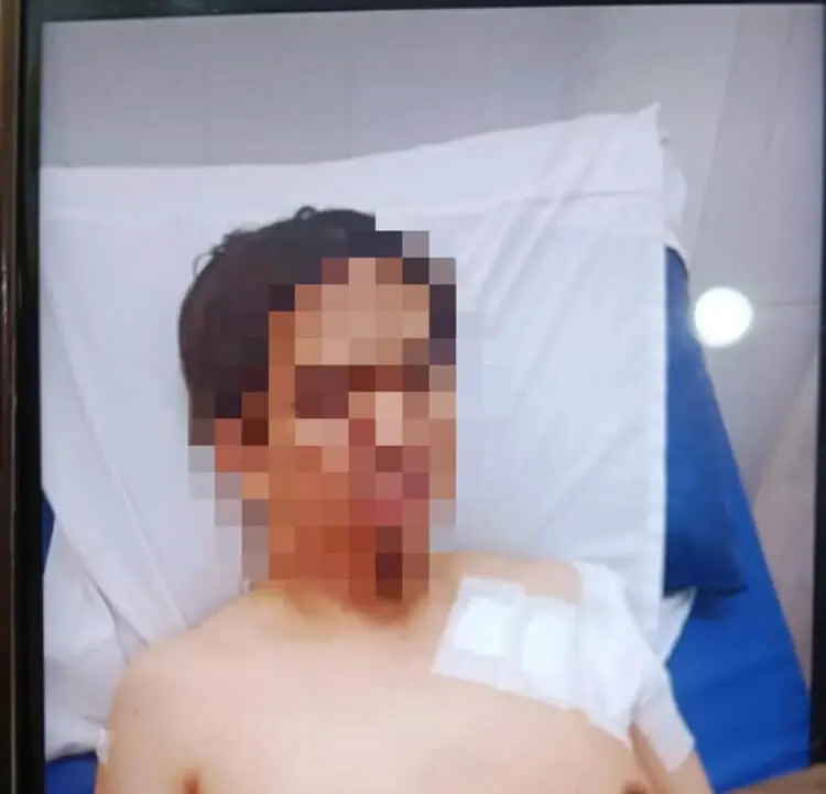 Gegara Dipaksa Putuskan Percintaan, Pemuda di Pamulang Tusuk Ayah Mantan Pacar