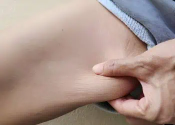 Memperlambat Tanda Penuaan