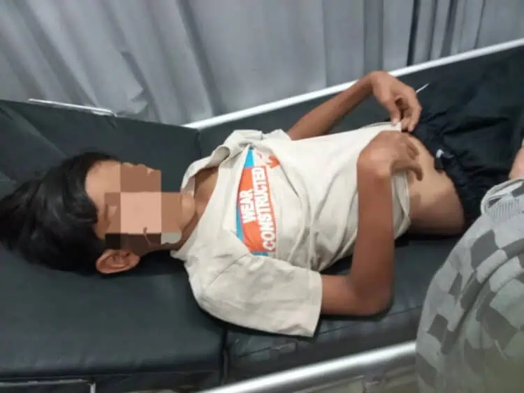 Siswa SD di Kabupaten Serang Diduga Jadi Korban Bullying Hingga Dilarikan ke RS