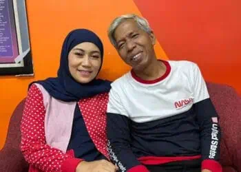 Kiwil Didiagnosis Diabetes Saat Hendak Jalani Operasi Hernia   