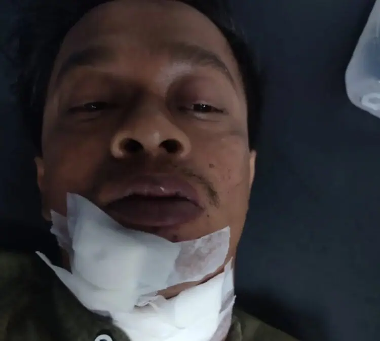 Dibegal, Seorang Pria Terkapar Bersimbah Darah di Sukamulya
