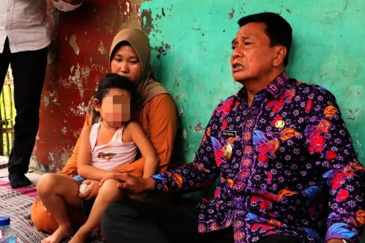 Kunjungi Anak Penderita Kanker Mata di Kronjo, Bupati Tangerang Beri Dukungan Penuh