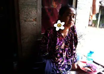 Idap Tumor di Leher, Warga Cimanggu Pandeglang Berharap Uluran Tangan Dermawan