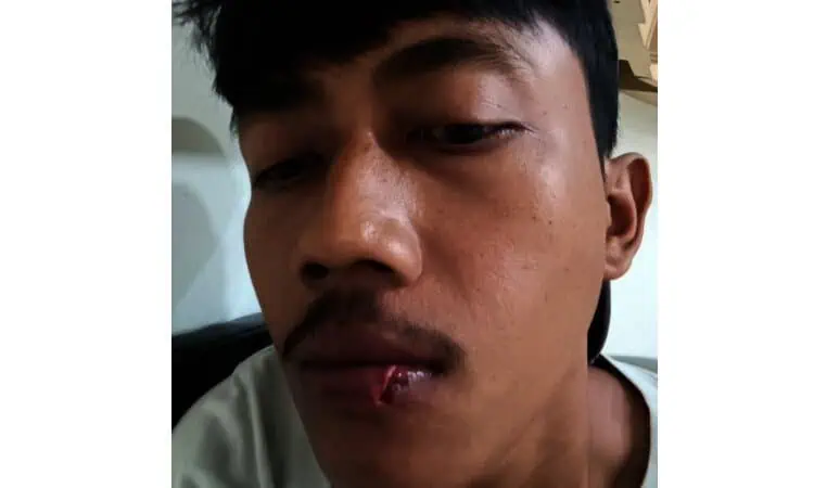 Diserang Saat Gelar Aksi Demo, Kelompok Mahasiswa di Kota Tangerang Lapor Polisi