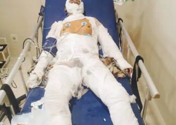 Korban Ledakan Pondok Cabe Ilir Meninggal Dunia Setelah Dirawat Seminggu
