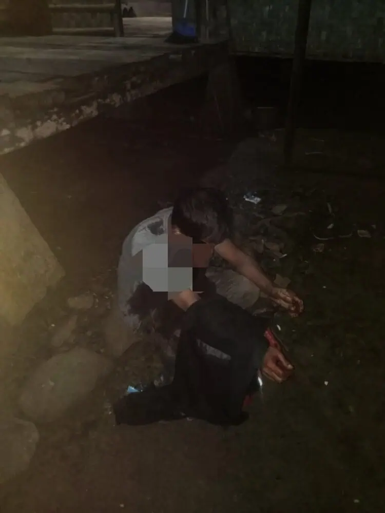 Tukang Opang di Pandeglang jadi Korban, Luka Berat di Leher dan Motor Dibawa Kabur Pelaku