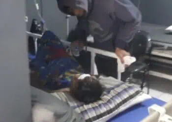 Beleson Meledak, Dua Bocah di Lebak Alami Luka Bakar Serius