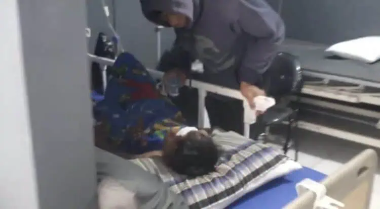 Beleson Meledak, Dua Bocah di Lebak Alami Luka Bakar Serius