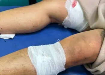 Tegur Aksi Pemalakan Pedagang, Warga Serua Dikeroyok Lalu Ditusuk