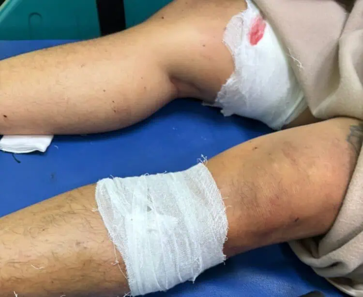 Tegur Aksi Pemalakan Pedagang, Warga Serua Dikeroyok Lalu Ditusuk