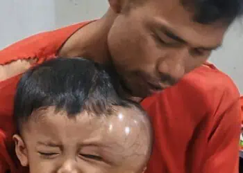 Anaknya Derita Tumor Ganas, Warga Cigeulis Pandeglang Butuh Uluran Tangan Dermawan