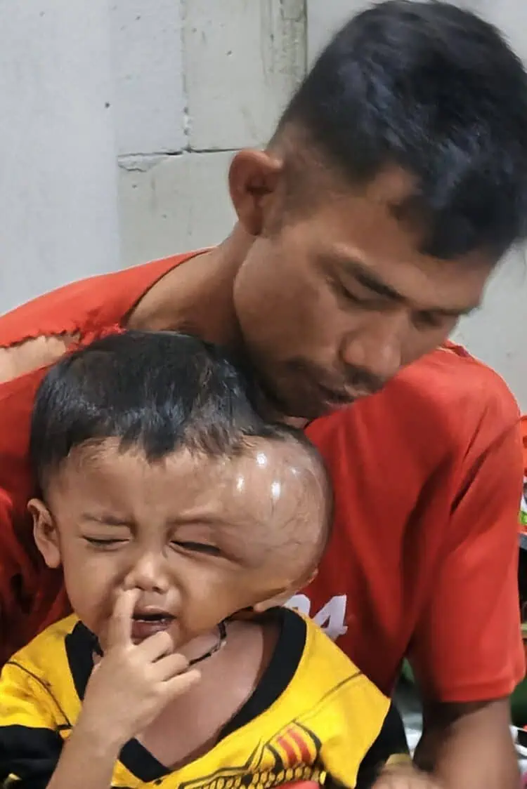Anaknya Derita Tumor Ganas, Warga Cigeulis Pandeglang Butuh Uluran Tangan Dermawan
