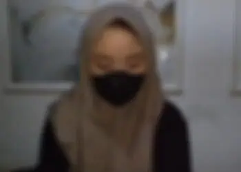 Korban perilaku kekerasan sang kekasih, berinisial B. (ISTIMEWA)