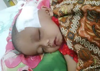 Farhan Penderita Tumor Asal Pandeglang Akhirnya Di Biopsi Di RS Dharmais