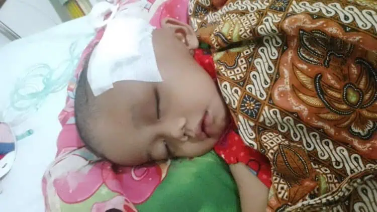 Farhan Penderita Tumor Asal Pandeglang Akhirnya Di Biopsi Di RS Dharmais