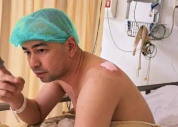 Kondisi Raffi Ahmad Usai Jalani Operasi Lipoma