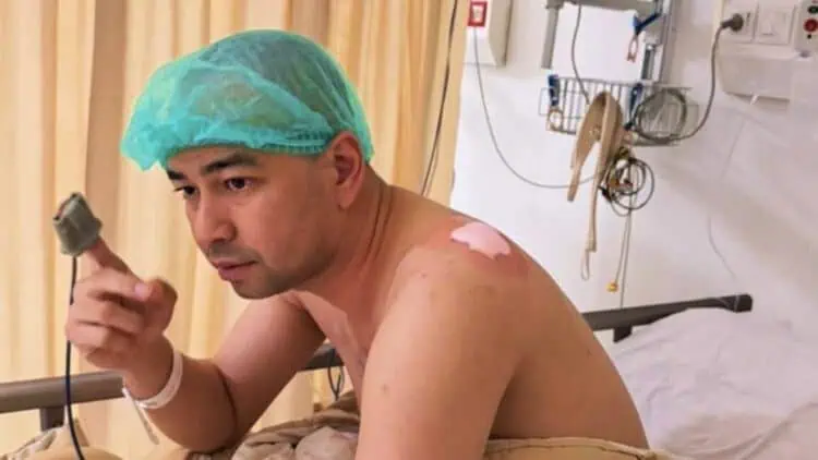 Kondisi Raffi Ahmad Usai Jalani Operasi Lipoma