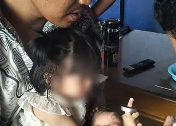 Ikut Orang Tua Hadir di Hajatan, Jari Balita di Ciledug Tersangkut Seng