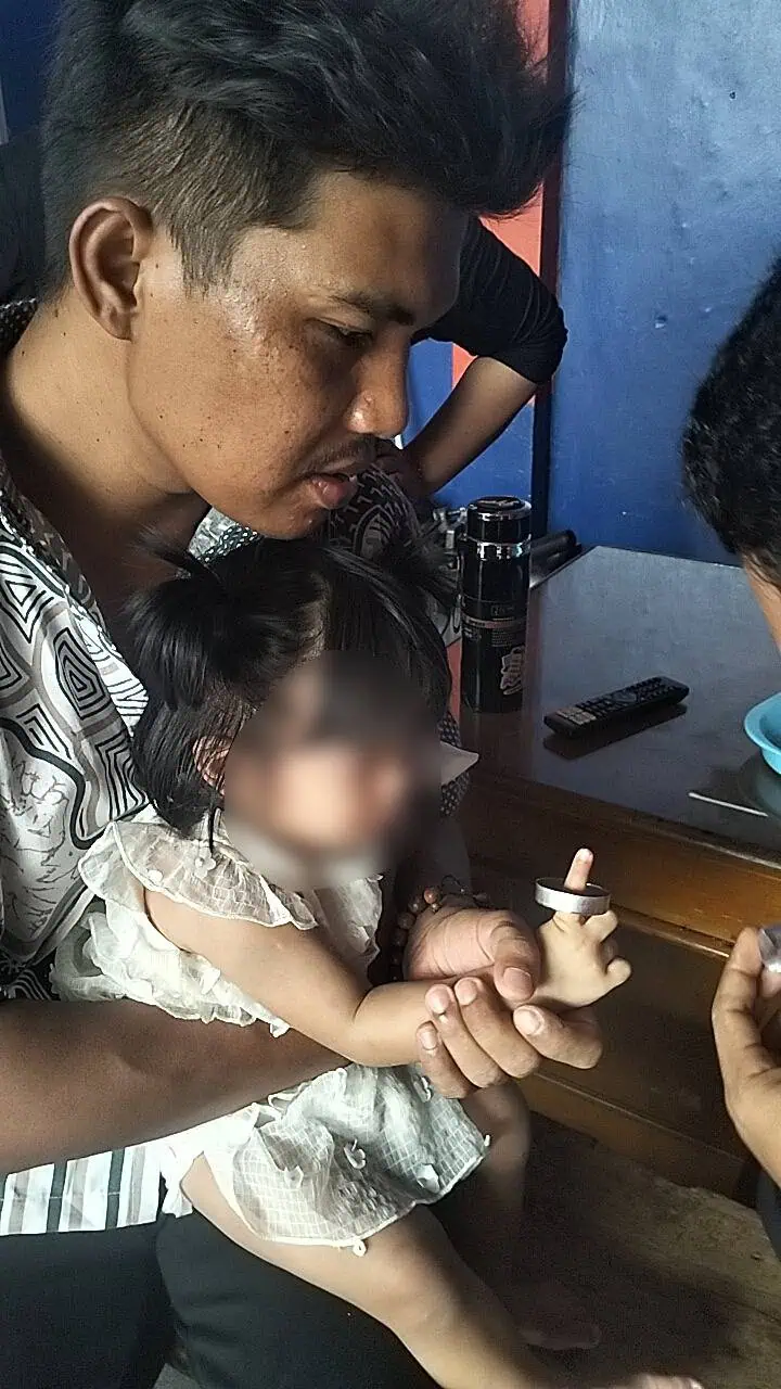 Ikut Orang Tua Hadir di Hajatan, Jari Balita di Ciledug Tersangkut Seng