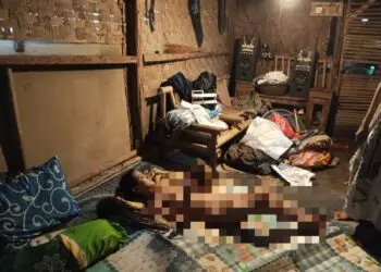 BERBARING - Siti Lutfiah (19), warga Kampung Kubang, Desa Mekarwangi, Kecamatan Saketi, Kabupaten Pandeglang, hanya bisa berbaring diatas kasur di rumahnya, dengan segala keterbatasan yang dialaminya. (ISTIMEWA)