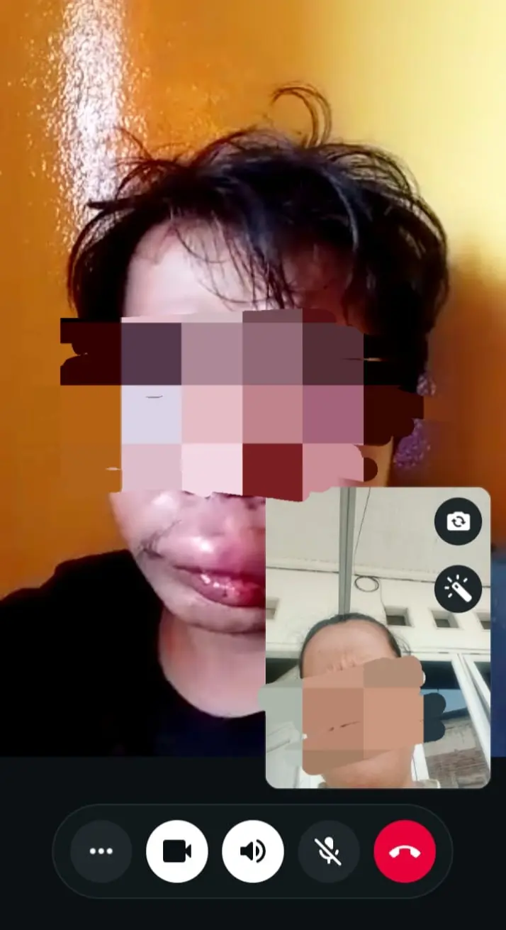 Kisah Pilu PG di Panongan Tangerang: Diduga Dianiaya 5,5 Jam, Dilecehkan, dan Diancam Pisau oleh Rekan Kerja