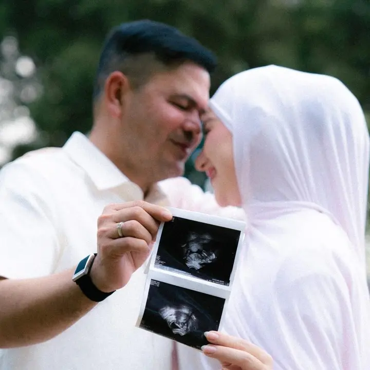 Selamat! Irish Bella Hamil Anak Pertama dari Haldy Sabri