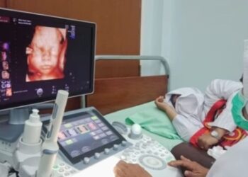 Jangan Tertipu Test Pack Positif, Dokter RS Sari Asih Ungkap Pentingnya USG Dini Cegah Hamil Anggur