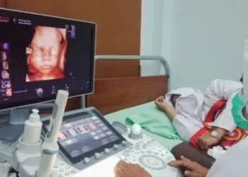 Jangan Tertipu Test Pack Positif, Dokter RS Sari Asih Ungkap Pentingnya USG Dini Cegah Hamil Anggur