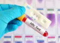 203 Kasus HIV Ditemukan di Kabupaten Tangerang, Didominasi Gay