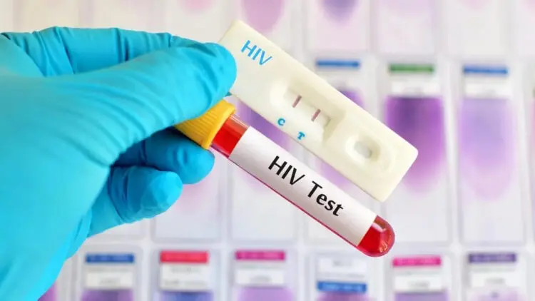 203 Kasus HIV Ditemukan di Kabupaten Tangerang, Didominasi Gay