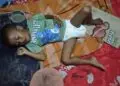 TERBARING LEMAH: Juned (4), terbaring lemah dan tidak masuk dalam program MBG. (ISTIMEWA)