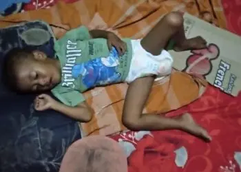 TERBARING LEMAH: Juned (4), terbaring lemah dan tidak masuk dalam program MBG. (ISTIMEWA)