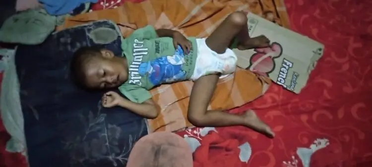 TERBARING LEMAH: Juned (4), terbaring lemah dan tidak masuk dalam program MBG. (ISTIMEWA)